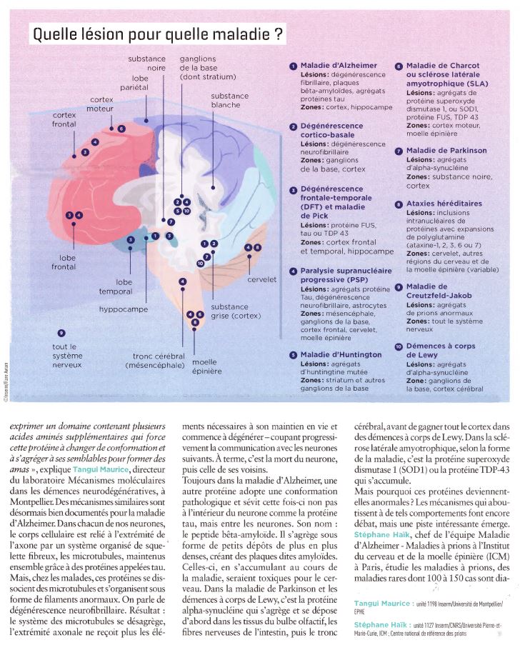 article-inserm-maladies-neurodégénératives