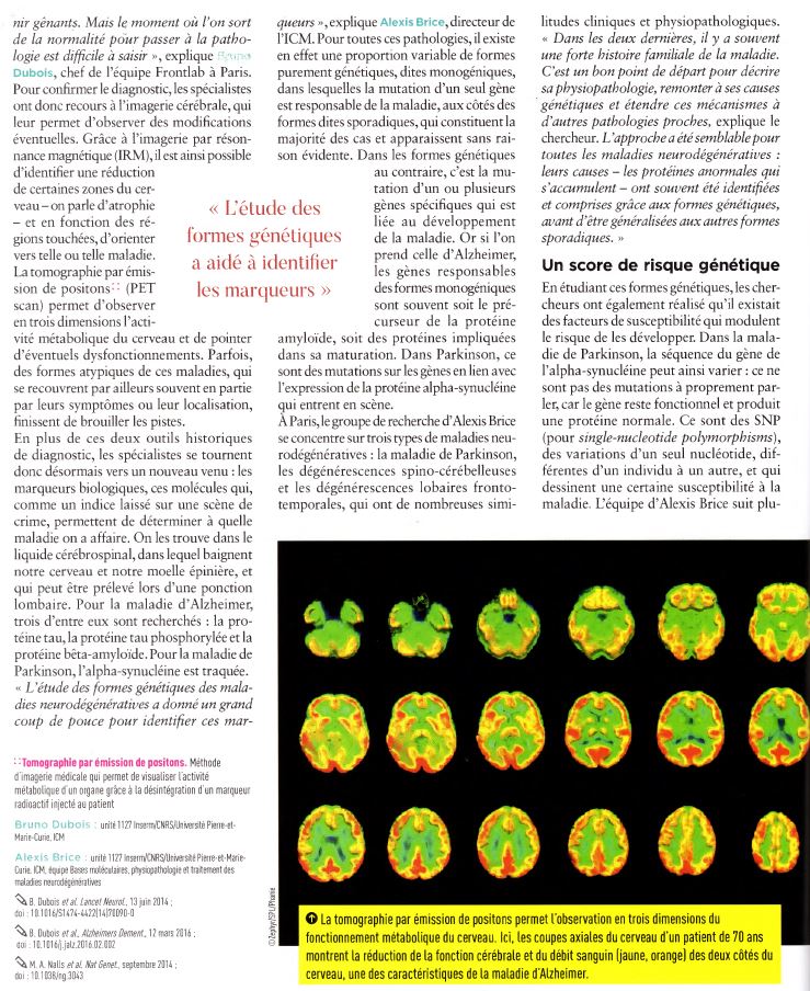 article-inserm-maladies-neurodégénératives